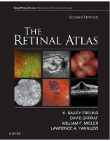 THE RETINAL ATLAS 2nd Edition Part 1..pdf